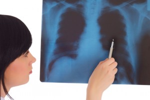 radiografie-pulmonara-publi